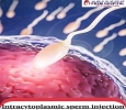 Intracytoplasmic sperm injection| Prem hospital